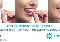 Invisalign 3