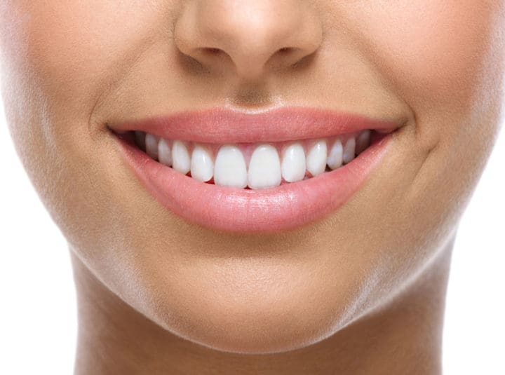 How To Get a Whiter Smile fast way to whiten teeth