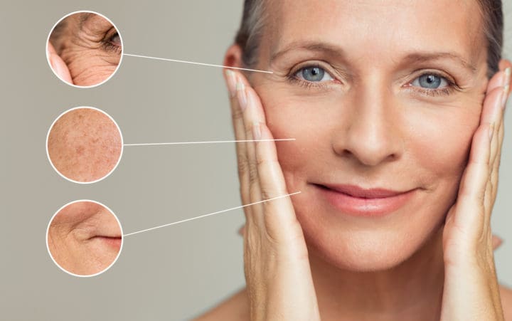 5 Solutions for Aging Skin Concerns 