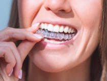 Debunking Common Myths About Invisalign Treatment