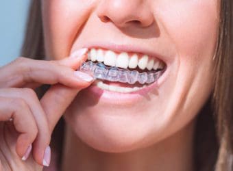 Debunking Common Myths About Invisalign Treatment