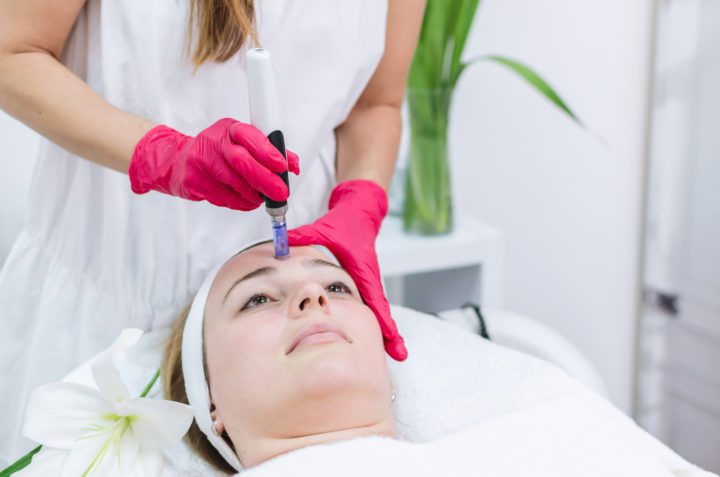 What Does Microneedling Help With? A Guide to Its Benefits