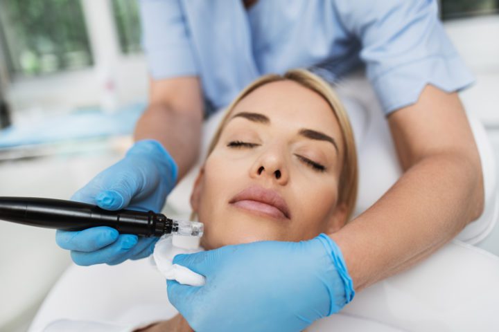 What Does Microneedling Help With? A Guide to Its Benefits