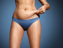 Does Ultrasonic Fat Cavitation Work?