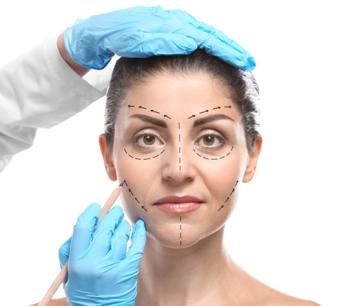 What is a Plastic Surgery Face Lift?