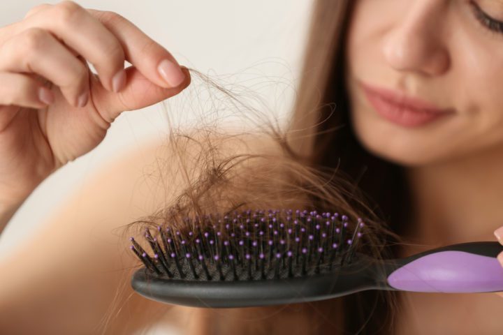 Can Stress and Anxiety Cause Hair Loss?