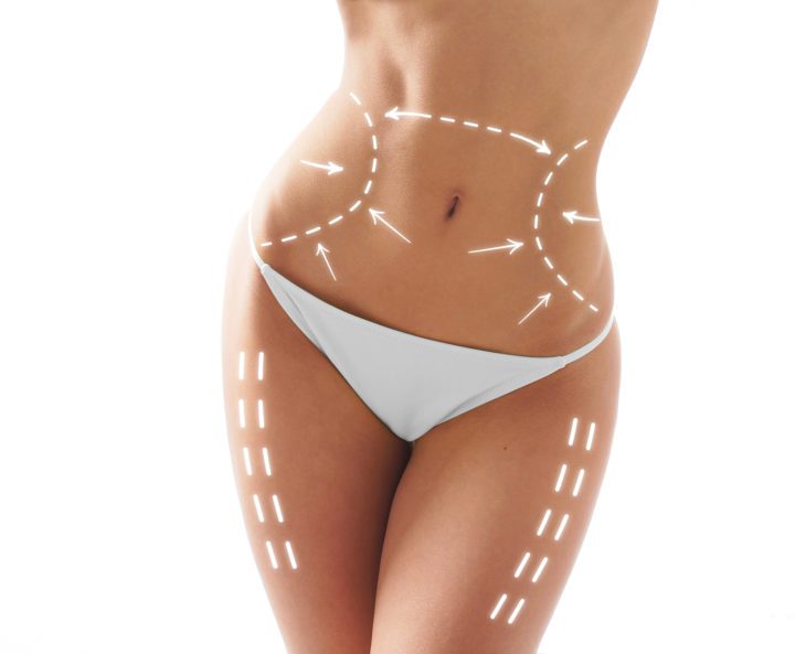 Freeze Your Way to Fabulous: The Skinny on CoolSculpting