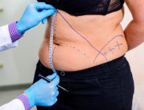 What is Mommy Makeover Plastic Surgery?